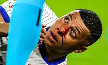 एम्बाप्पेले मास्क लगाएर खेल्ने